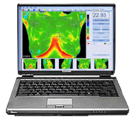infrared screening software anatomy overlay